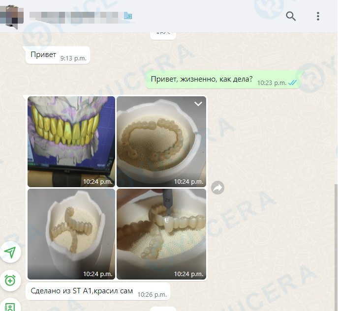 ইউসেরা 4D প্রো উচ্চ - নির্ভুলতা 3D মাল্টিলেয়ার ডেন্টাল জিরকোনিয়া ব্লক স্থিতিশীল এবং নির্ভরযোগ্য, আদর্শ পুনরুদ্ধার ফলাফল তৈরি করে